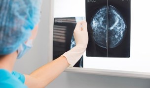 Women offered NHS breast screening after missed invitations top image