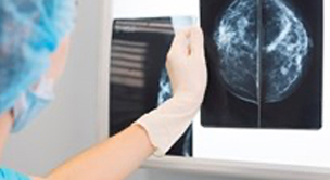 NHS BSP & ABS Audit of Screen Detected Breast Cancer